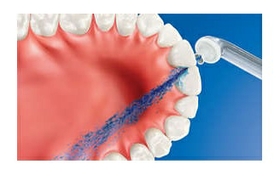 تزيل ما يصل الى ٩٩.٩% من ترسبات الأسنان