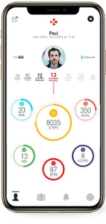 Sleep monitoring