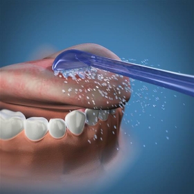 Replacement Tip-Tongue Cleaner